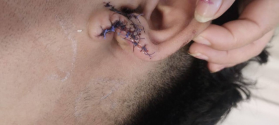 Violencia en el norte: Le arrancó parte de la oreja y se la tragó 